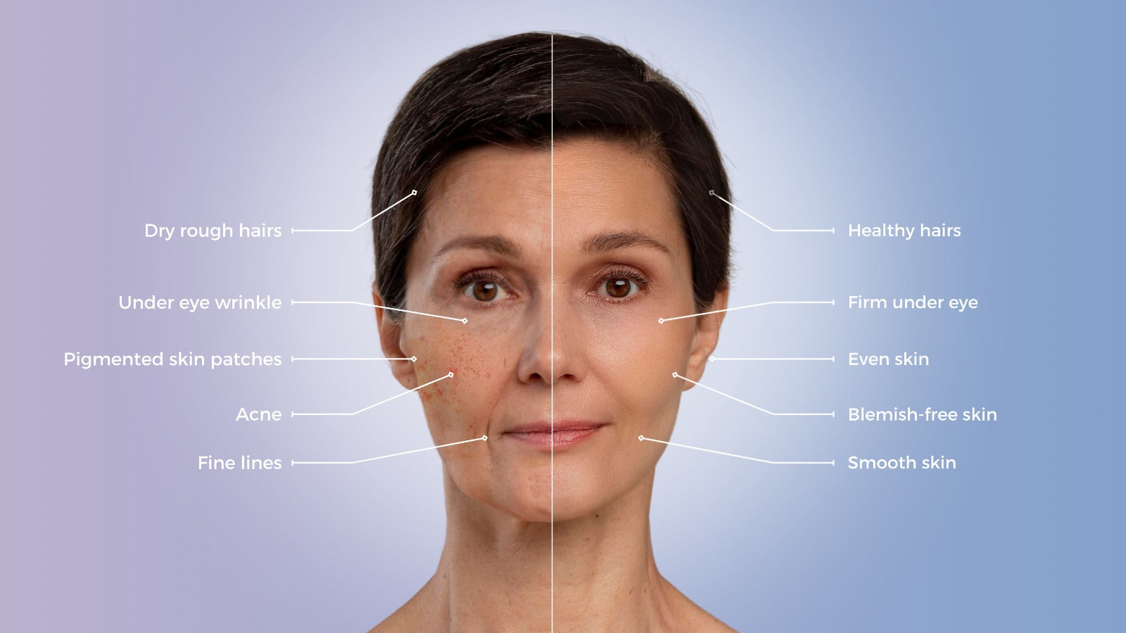 How Glycation Affects Skin As Per Age