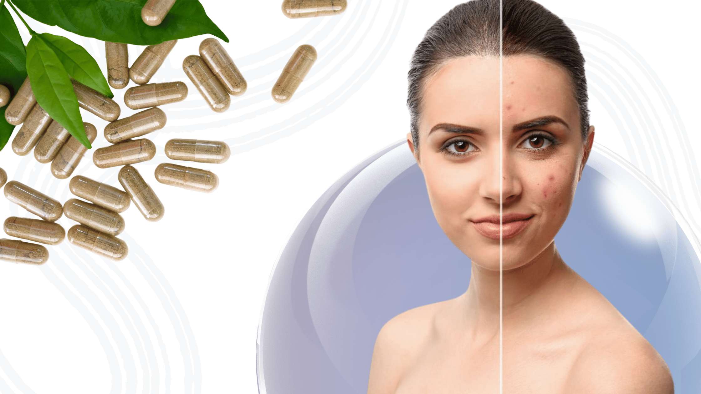 How Lactofyn™ Fights Hormonal Acne with Lactoferrin & Probiotics