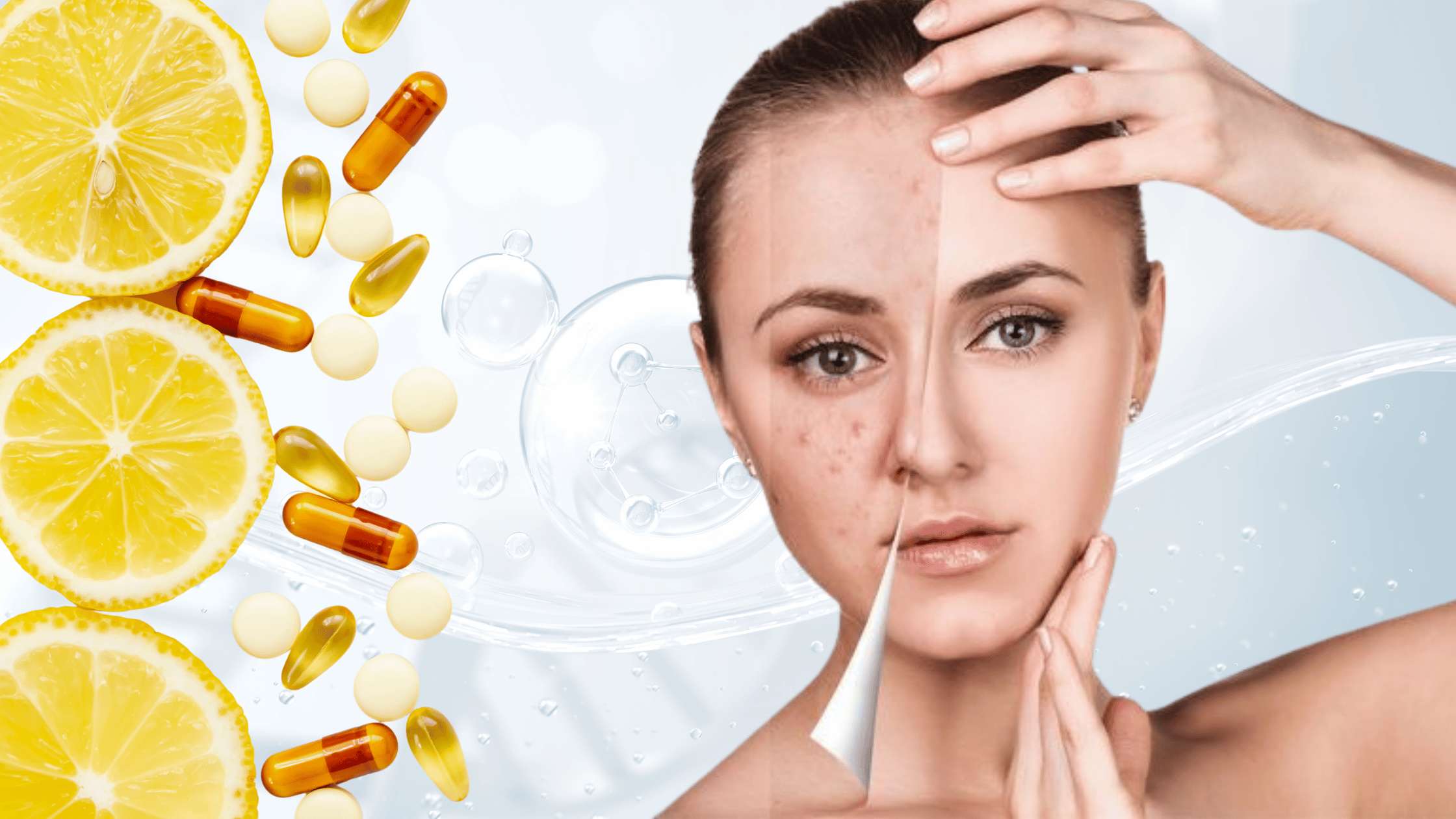 The Role of Vitamins and Probiotics in Fighting Acne