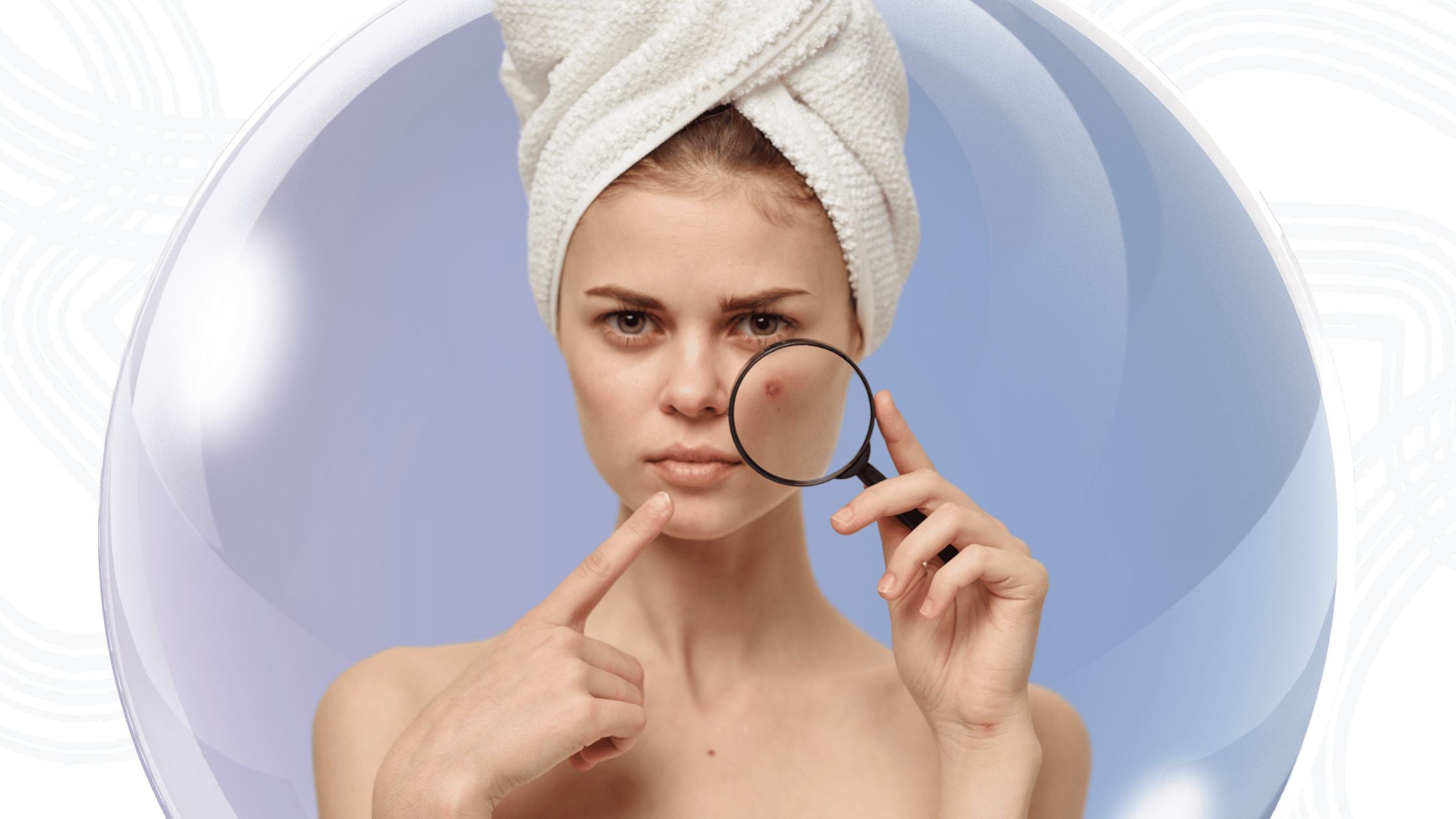 Top 7 Supplements for Hormonal Acne (Backed by Science)