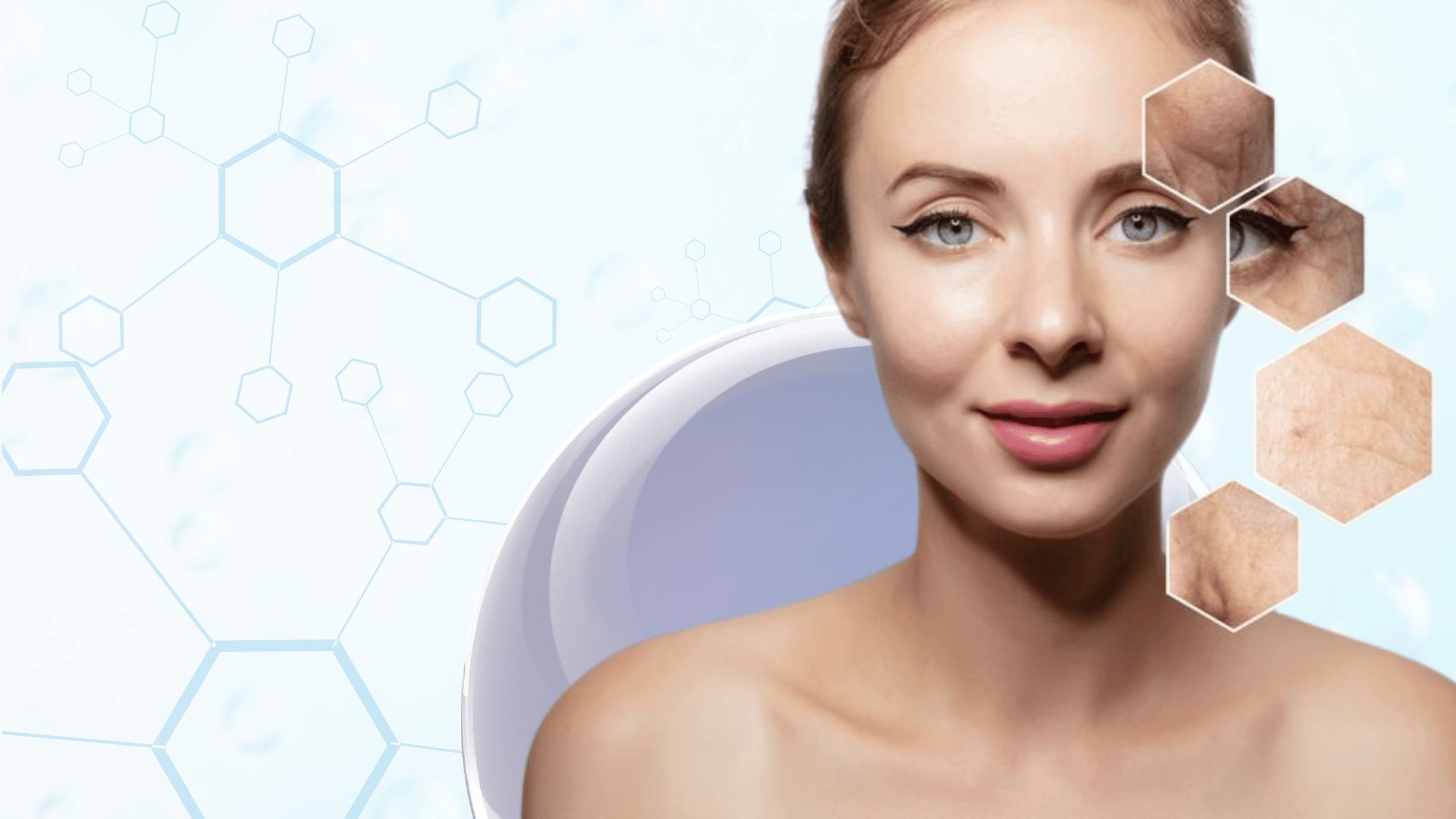 Can Liposomal Glutathione Help with Acne and Skin Inflammation?