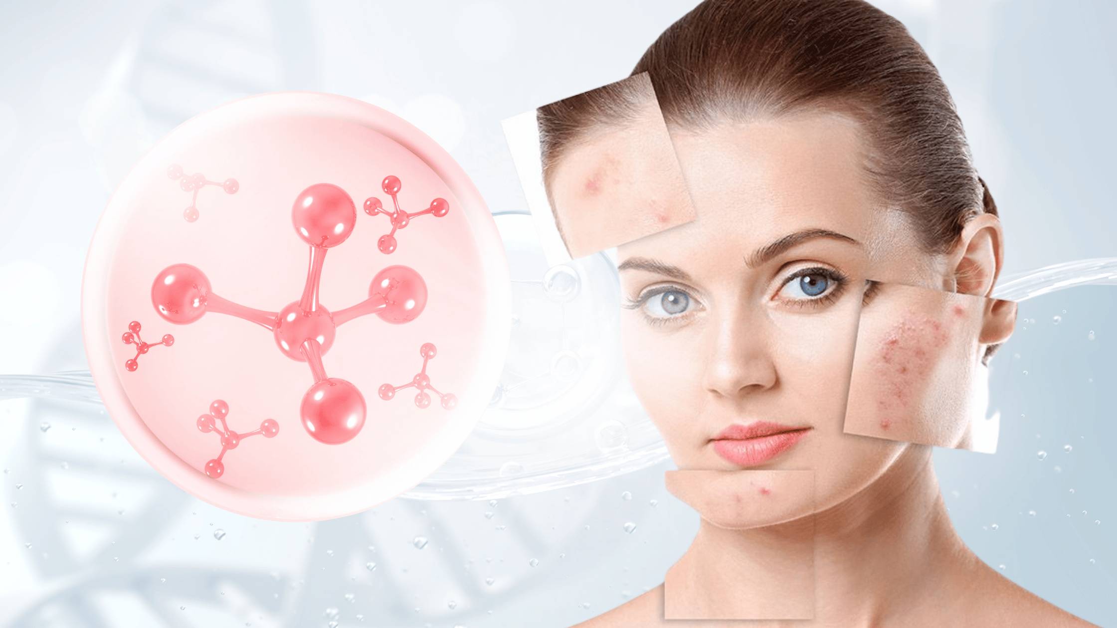 Achromaxyl For Skin Brightening